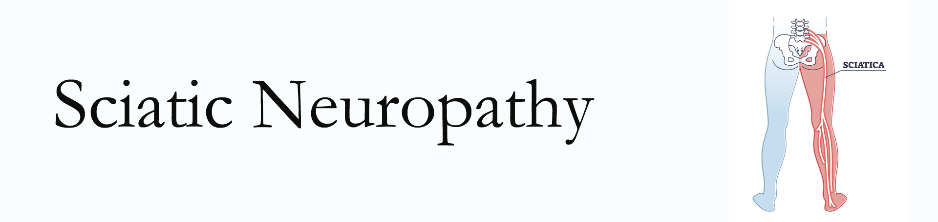 Nashua neuropathy pain (sciatica) 
